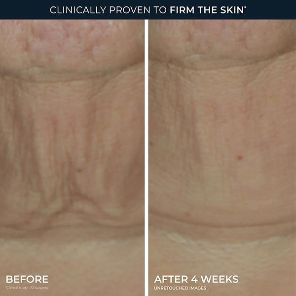 Derm Correxion Firming stick